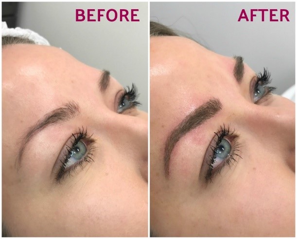 Microblading